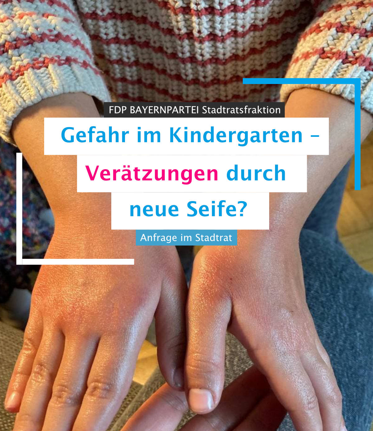 Anfrage_Verätzungen_Seife_Kindergarten